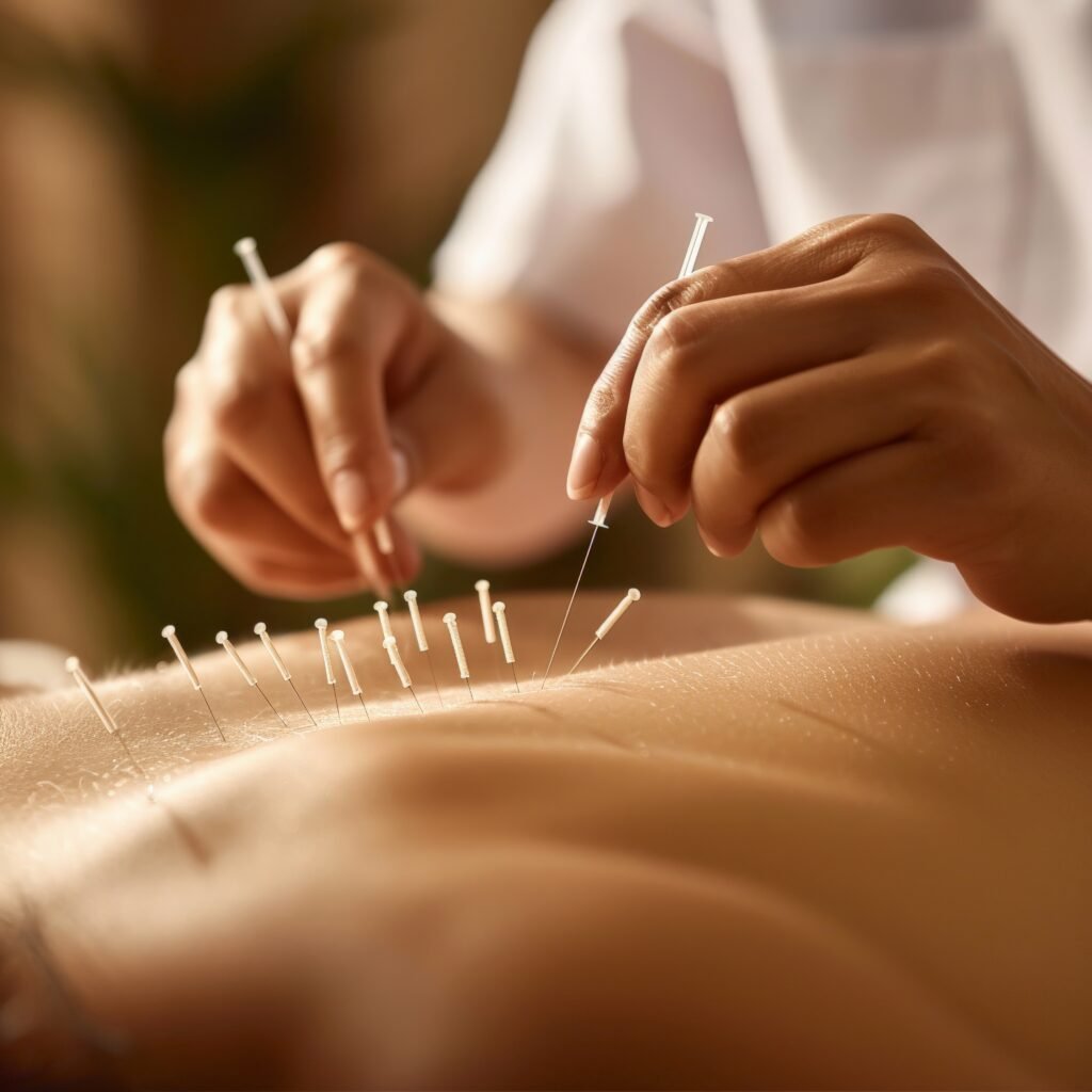 Acupuntura